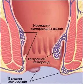 Факторите способстващи тяхното появяване:
